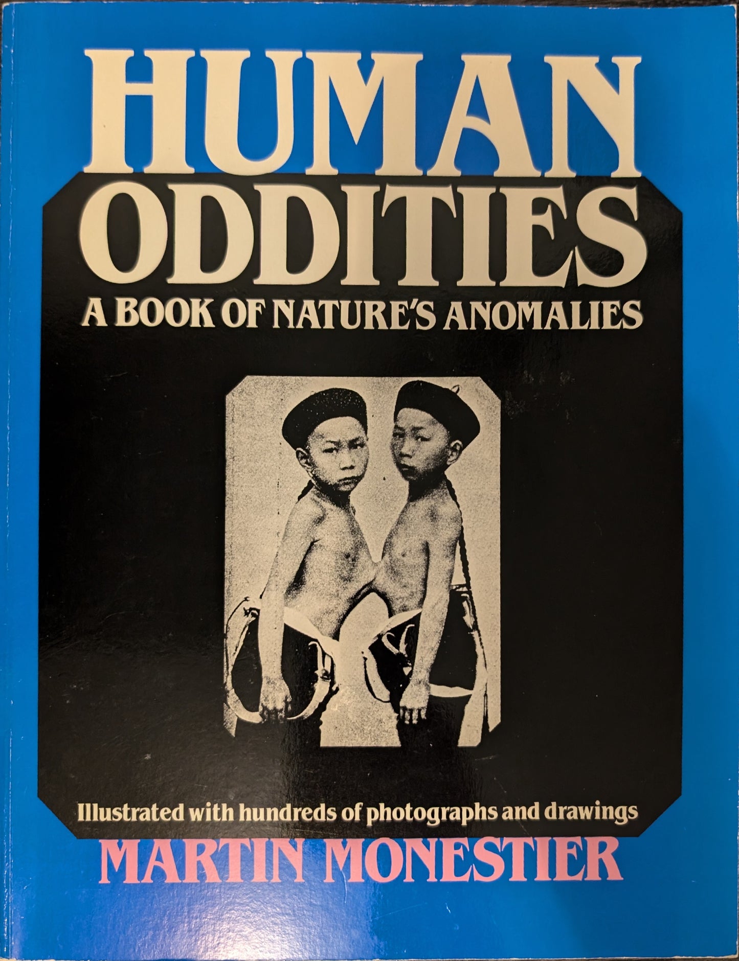 Human Oddities: A Book of Nature's Anomalies by Martin Monestier